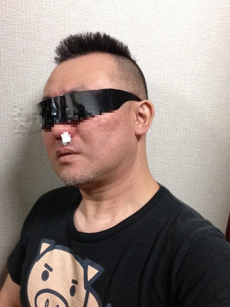 鼻栓で急場しのぎ